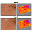 Mini Retinol